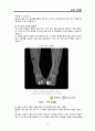 당뇨 DM FOOT CASE STUDY (당뇨병성 발 궤양) A+ 10페이지