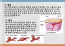 중환자실 case study - SAH(지주막하 출혈) A+자료입니다.  3페이지