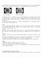 Subdural hemorrhage(경막하 출혈) - case study 4페이지