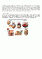 Subdural hemorrhage(경막하 출혈) - case study 7페이지