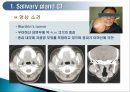 두경부 (Head & Neck) CT 에 관하여 8페이지