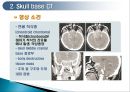 두경부 (Head & Neck) CT 에 관하여 14페이지