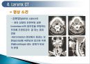 두경부 (Head & Neck) CT 에 관하여 23페이지