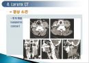 두경부 (Head & Neck) CT 에 관하여 24페이지