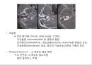 두경부 CT에 관한 PPT 자료 28페이지