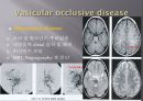 Brain CT에 관한 PPT 3페이지