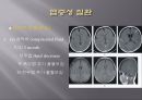 Brain CT에 관한 PPT 16페이지