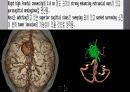 Brain CT에 관한 PPT 51페이지