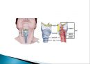 pharynx cancer(인두암)에 관한 PPT 9페이지