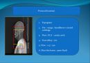 Pharynx CT에 관한 PPT자료 4페이지