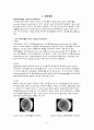 case NS SDH Closed Traumatic SDH(subdural hemorrhage) 경막하혈종 A+ 3페이지