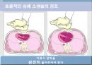 ACLS, advenced cardio vascular life support 8페이지