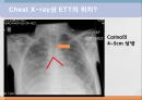 ACLS, advenced cardio vascular life support 18페이지