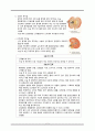 결석, 외상, 혈관성 대상자 간호, 결석간호, 외상간호, 혈관성대상자간호, 신결석, 방광결석, 신장손상 8페이지