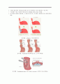 Hiatal hernia, Esophageal achalasia(식도 열공 탈장, 식도 이완불능증) 5페이지