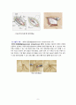 [성인간호학 A＋] 양측 서혜부 탈장(Bilateral inguinal hernia) 간호과정 case study 11페이지