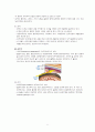성인간호 ICU case study- SAH(A+ 칭찬받은자료) 4페이지