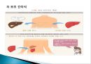 간이식의 이해 16페이지