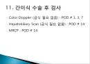 간이식의 이해 42페이지