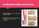Graves disease (그레이브스 병, 갑상선 항진증) 8페이지