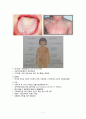 세균성 감염 (디프테리아, 백일해, 파상풍, 성홍열) 7페이지