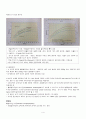 고빌리루빈혈증 Hyperbilirubinemia 5페이지