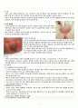 생식기 구조 이상 : 생식기 기형, 성선 발육장애, 자궁위치이상 4페이지