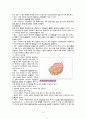간호,case study,여성(병동), 난소 낭종(ovarian cystic tumor) 4페이지