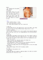간호,case study,여성(병동), 난소 낭종(ovarian cystic tumor) 6페이지
