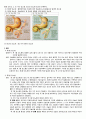 간호,성인 간호학, case study, 당뇨병 2페이지