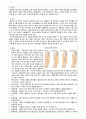 간호,성인 간호학,case study,골절,구획 증후군 2페이지