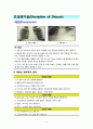 아동 폐렴 케이스 3페이지