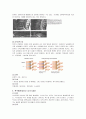 spine 수술 환자 간호 (척추관 협착증 케이스,spine케이스, spinal stenosis 간호과정, spinal stenosis 케이스, 척추관 협착증 간호과정, 척추관 협착증 CASE ) 8페이지