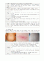 Cardiac Cirrhosis - (심장성간경화증 케이스, 심장성간경화증 간호과정, 심장성간경화증 간호진단, Cardiac Cirrhosis 케이스, Cardiac Cirrhosis case study, Cardiac Cirrhosis 간호과정) 4페이지