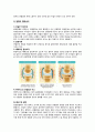 골관절염 케이스 6페이지