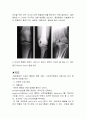 골관절염, 골관절염 case study, osteoarthritis 간호과정 5페이지