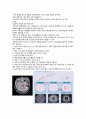 알츠하이머 케이스 스터디 6페이지