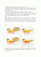 급성췌장염 케이스 스터디 A+ 예시문 (Acute pancreatitis, 급성 췌장염 간호과정, 급성췌장염 케이스, 급성췌장염 간호진단, 급성췌장염 문헌고찰) 4페이지