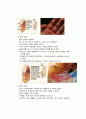 화상 케이스 스터디 (BURN CASE STUDY, FLAME BURN CASE, 화상 케이스, 화상 간호과정, 화상 간호진단, BURN 케이스 스터디, 번 케이스 스터디) 7페이지