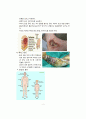 화상 케이스 스터디 (BURN CASE STUDY, FLAME BURN CASE, 화상 케이스, 화상 간호과정, 화상 간호진단, BURN 케이스 스터디, 번 케이스 스터디) 8페이지