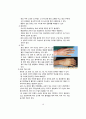 화상 케이스 스터디 (BURN CASE STUDY, FLAME BURN CASE, 화상 케이스, 화상 간호과정, 화상 간호진단, BURN 케이스 스터디, 번 케이스 스터디) 10페이지