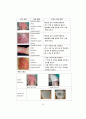 화상 케이스 스터디 (BURN CASE STUDY, FLAME BURN CASE, 화상 케이스, 화상 간호과정, 화상 간호진단, BURN 케이스 스터디, 번 케이스 스터디) 15페이지