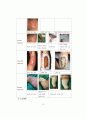 화상 케이스 스터디 (BURN CASE STUDY, FLAME BURN CASE, 화상 케이스, 화상 간호과정, 화상 간호진단, BURN 케이스 스터디, 번 케이스 스터디) 16페이지