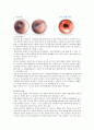 A+) PICU CASE, picu 케이스, 급성 위장염 케이스, 천식 케이스, 유아 케이스 스터디, 급성 위장염 CASE, 천식 CASE, 유아 CASE 4페이지