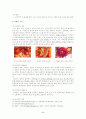 강력추천) Brain Tumor 뇌종양 케이스 스터디 A+ CASE, STUDY, 간호과정, 사례연구 3페이지