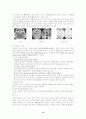강력추천) Brain Tumor 뇌종양 케이스 스터디 A+ CASE, STUDY, 간호과정, 사례연구 6페이지