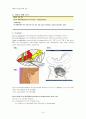 [성인간호학] 신경외과 케이스 스터디 : clonic hemifacial spasm(반얼굴경련) 10페이지
