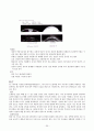 내과 케이스스터디 : Unstable Angina Pectoris (불안정형 협심증) 20페이지