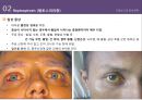 간호 미생물학-가을열성질환 및 결핵균-정의, 원인, 치료 15페이지
