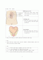 난산의 유형 및 간호 (태아이상) 9페이지